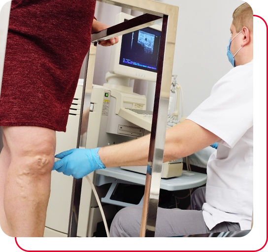 a vascular surgeon or phlebologist makes an ultrasound of varicose veins on the legs of a female patient.